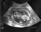 baby 2 -13 weeks B